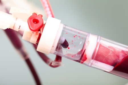 blood transfusionの写真素材