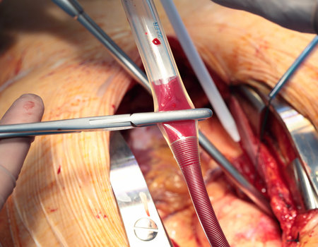 Operating incision and surgical instruments