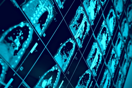 CT scan of thoracic segment. scientific backgroundの写真素材