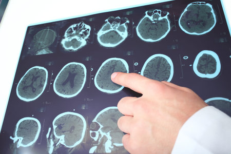 Doctor identifies on the fragment of CT image 