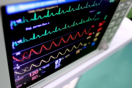 Medical background  Monitor with varicolored schedules  curves の写真素材