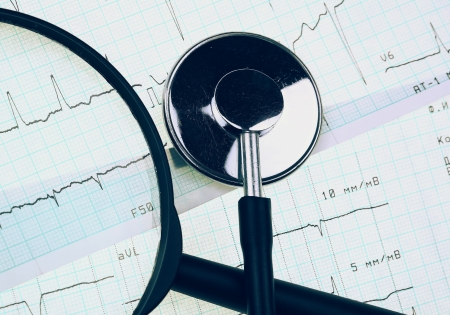 Medical objects. Stethoscope and magnifier on ECG paper. の写真素材