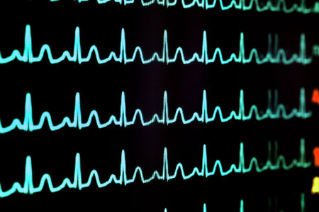 Screen with cardiogram 
