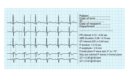 ECG on paper  vector  Suitable for professional useのイラスト素材