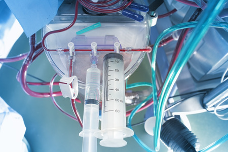Sophisticated equipment in hospital の写真素材