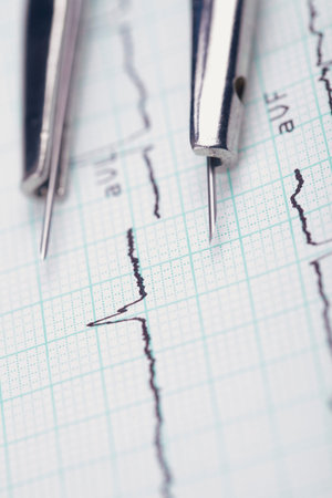 ECG analysis. Compasses on medical cardiogram 