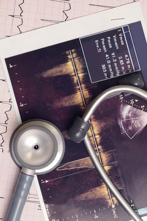 Stethoscope and medical records の写真素材