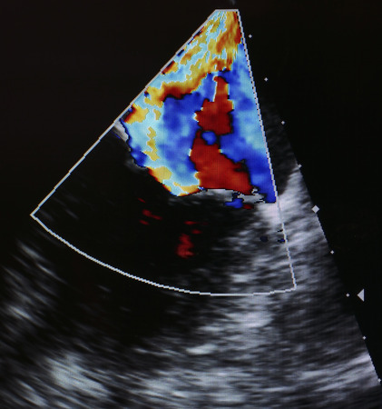 Detail of colored dopprer. Ultrasound technology の写真素材