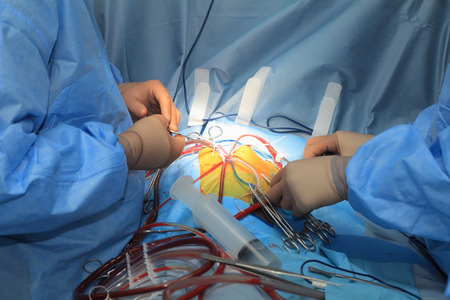 On the surgical table の写真素材