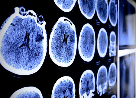 CT x-ray の写真素材