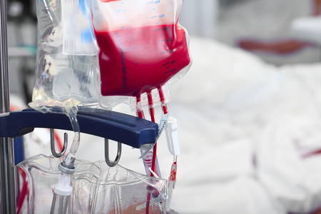 Before transfusion dose blood inside hospital roomの写真素材