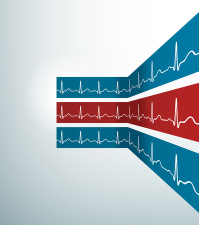 Abstract vector stripes with heartbeat line. Illustrationの写真素材