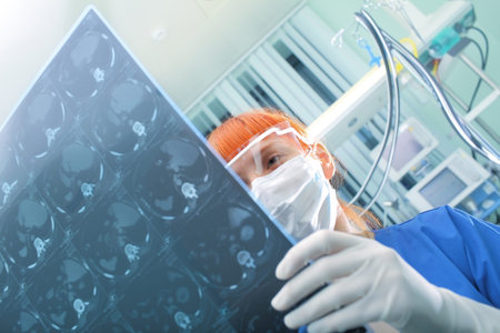 Female doctor with glasses and mask inspects CT picture