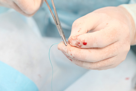 Surgical needle and the needle holder in the hands of the surgeonの写真素材
