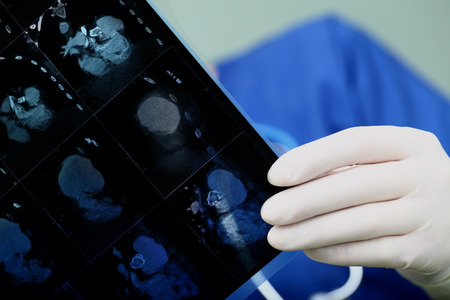 Doctor is working attentively analyzes patient dataの写真素材