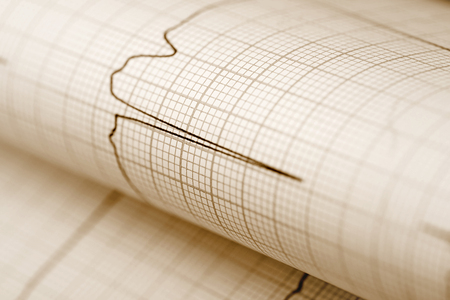 ECG paper medical backgroundの写真素材