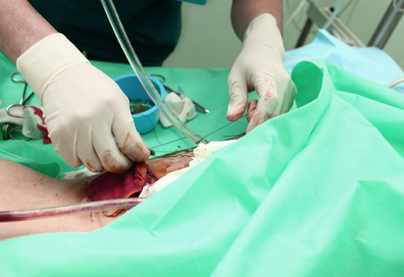 Doctor holds a surgical procedure in hospitalの写真素材