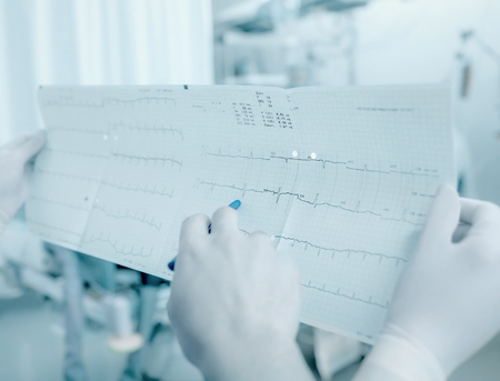 Discussion between doctors about the patient's cardiogramの写真素材