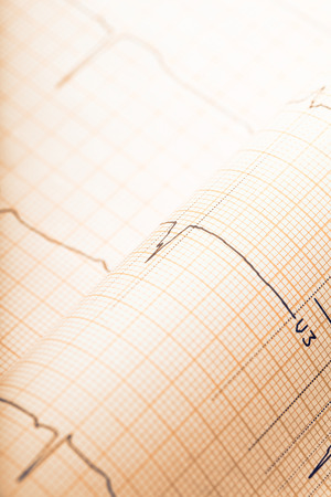 Retro styled ECG paper background.の写真素材