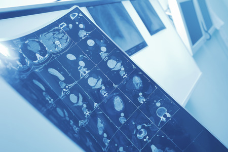 MRI image of patient in doctors office.の写真素材