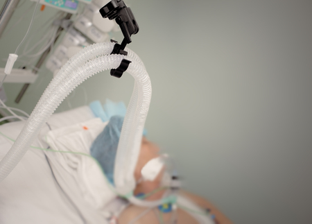 Patient is unconscious in the intensive care unitの写真素材