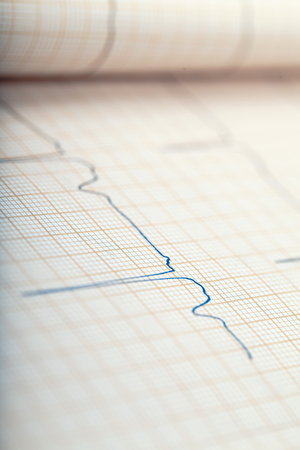 Recording of cardiac activity on ECGの写真素材