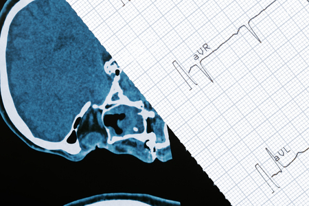 Fragment of CT scann and cardiogramの写真素材