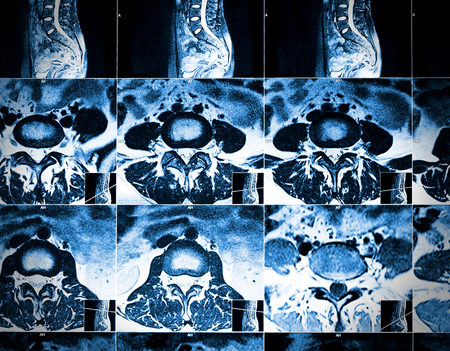 CT scan of internal organsの写真素材