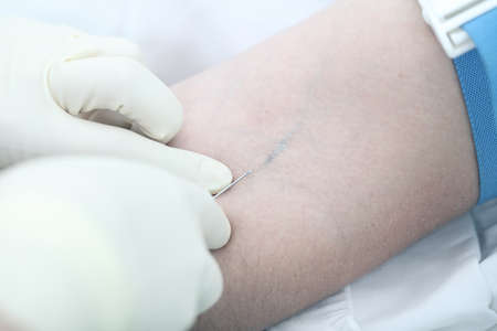 Medical operation: intravenous injection. Close-up photoの写真素材