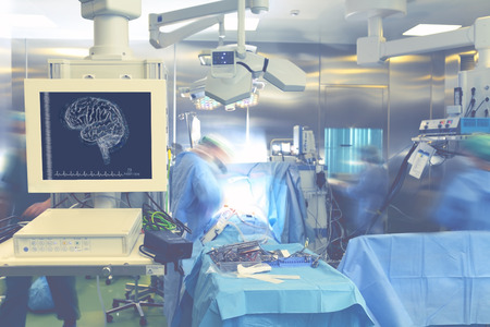Monitoring brain activity during surgery.の写真素材