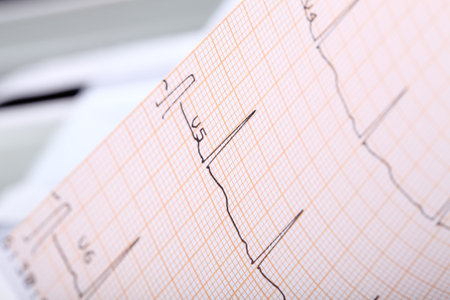 ECG complex on the paper.