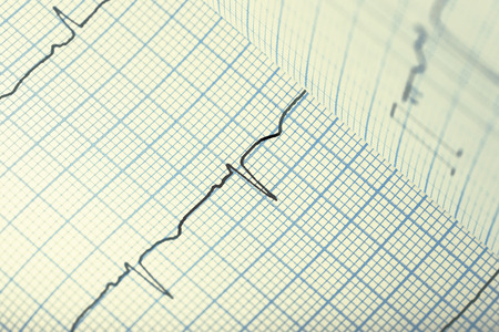 ECG paper as medical background.の写真素材