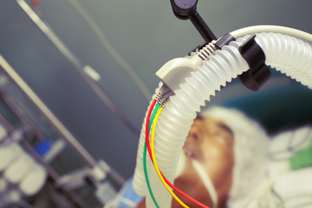 Breathing equipment in intensive care unit.の写真素材