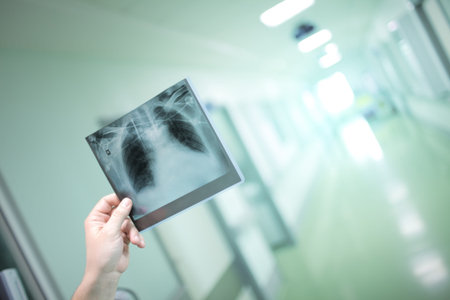 X-ray image of patient in man`s hand.
