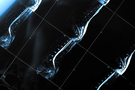 MRI scan of the waistの写真素材