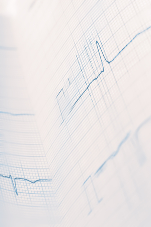 Movement on the electrocardiogramの写真素材