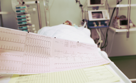 ECG of the patient in serious condition in the ICU.の写真素材