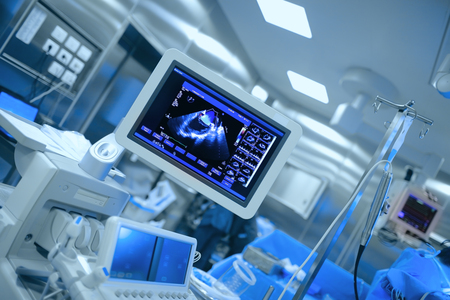 Ultrasonic monitoring of patient's heart during cardiac surgery.の写真素材