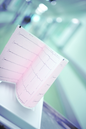 Heart examination test result on the background of blurred hospital corridor.の写真素材