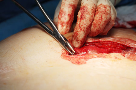 Surgeon with hand tool treats the deep injury of patient.