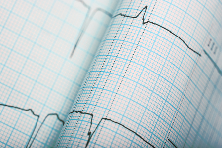 ECG lines on the bended graph paper close-up.の写真素材