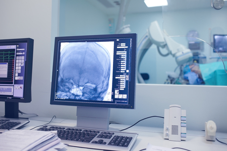 X-ray scan of patient skull on the monitor during surgical procedure.の写真素材