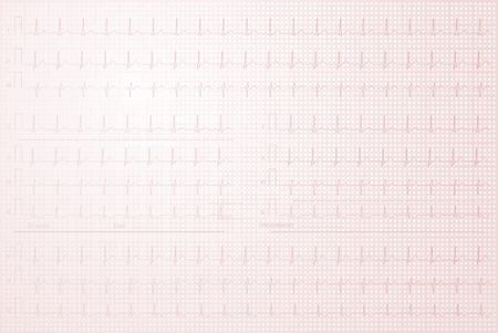 Cardiogram with lined paper as backgroundの写真素材