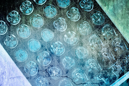 MRI scan of human head on the grunge concrete wall background.の写真素材