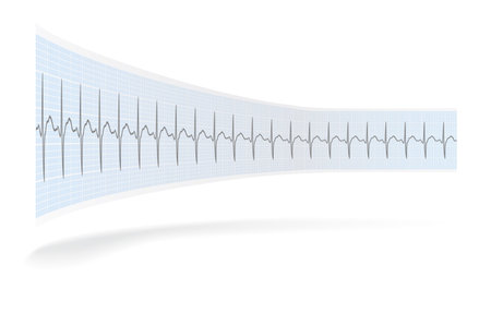 Folded ECG record paper with shadow on the white background, vector.のイラスト素材