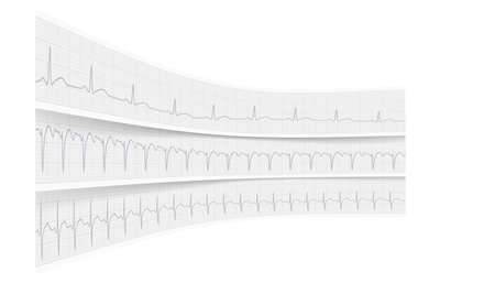 Background stones vector illustrationのイラスト素材