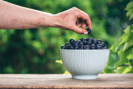 Blueberries in a bowl on a wooden table and a psoriasis handの写真素材