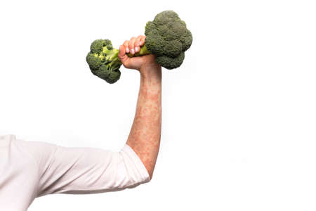 Broccoli and a psoriasis handの写真素材