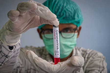 illustration of a blood sample from a suspect Coronavirus held by a doctorのeditorial素材