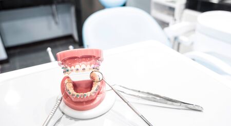 orthodontic model and dentist tool - demonstration teeth model of varities of orthodontic bracket or braceの写真素材